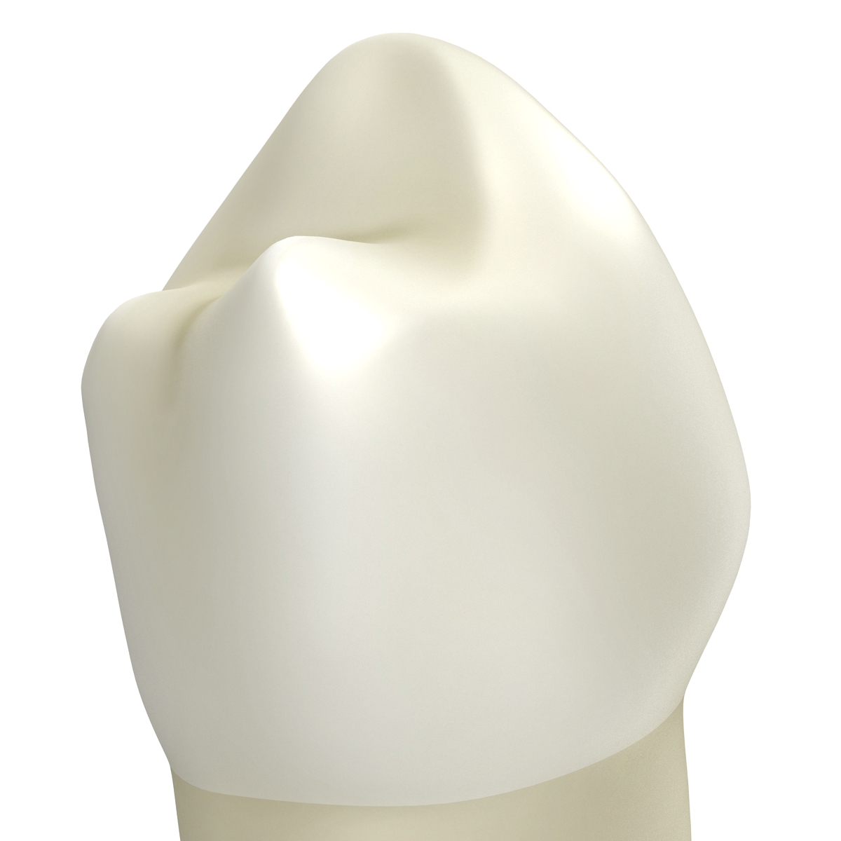 3D model Bicuspid