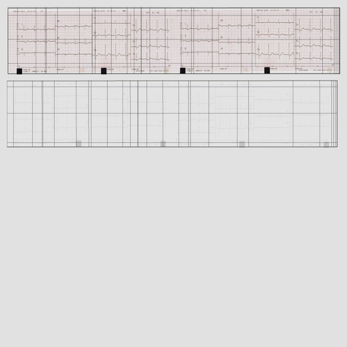 Electrocardiograph Report in Paper Form 3D model