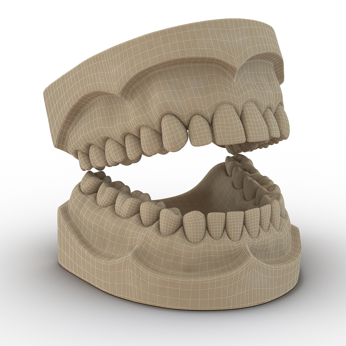 3D Dental Mold