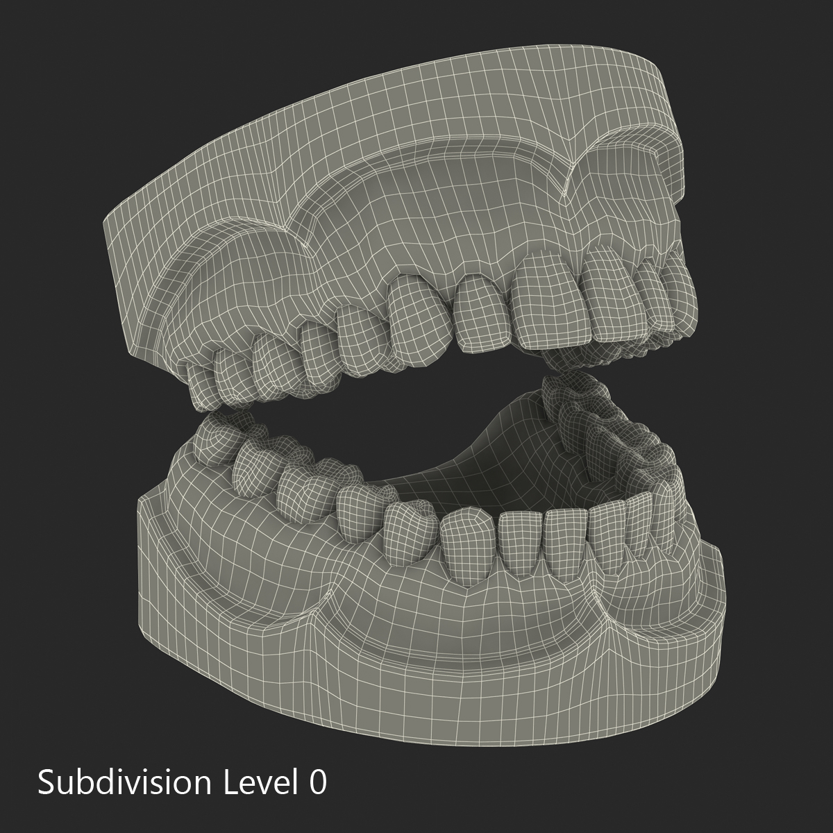 3D Dental Mold