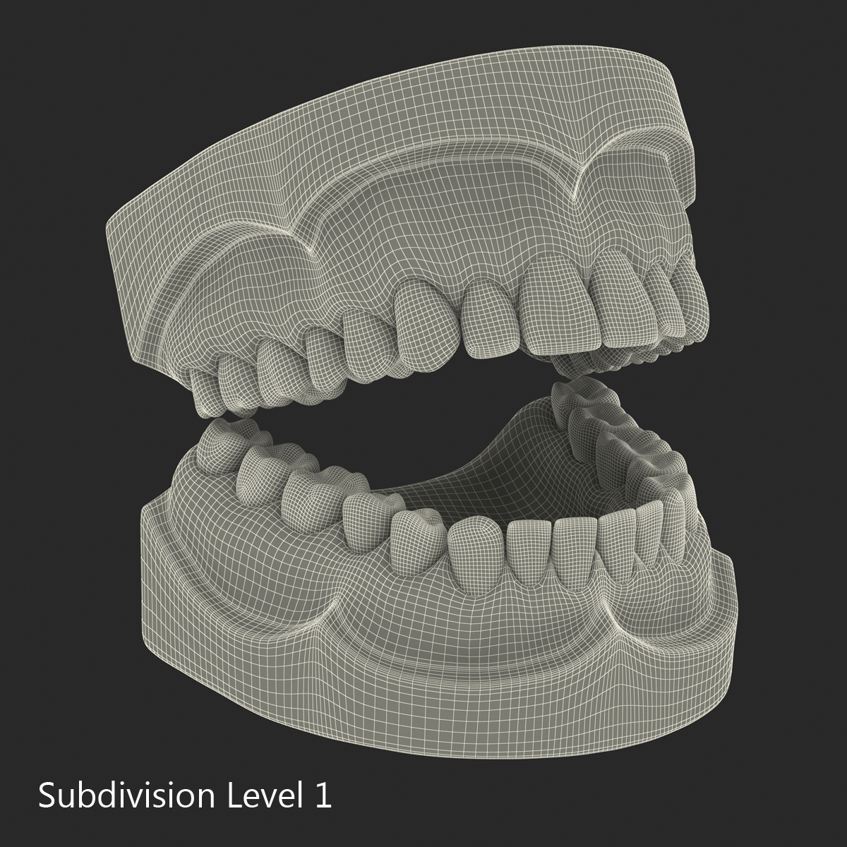 3D Dental Mold