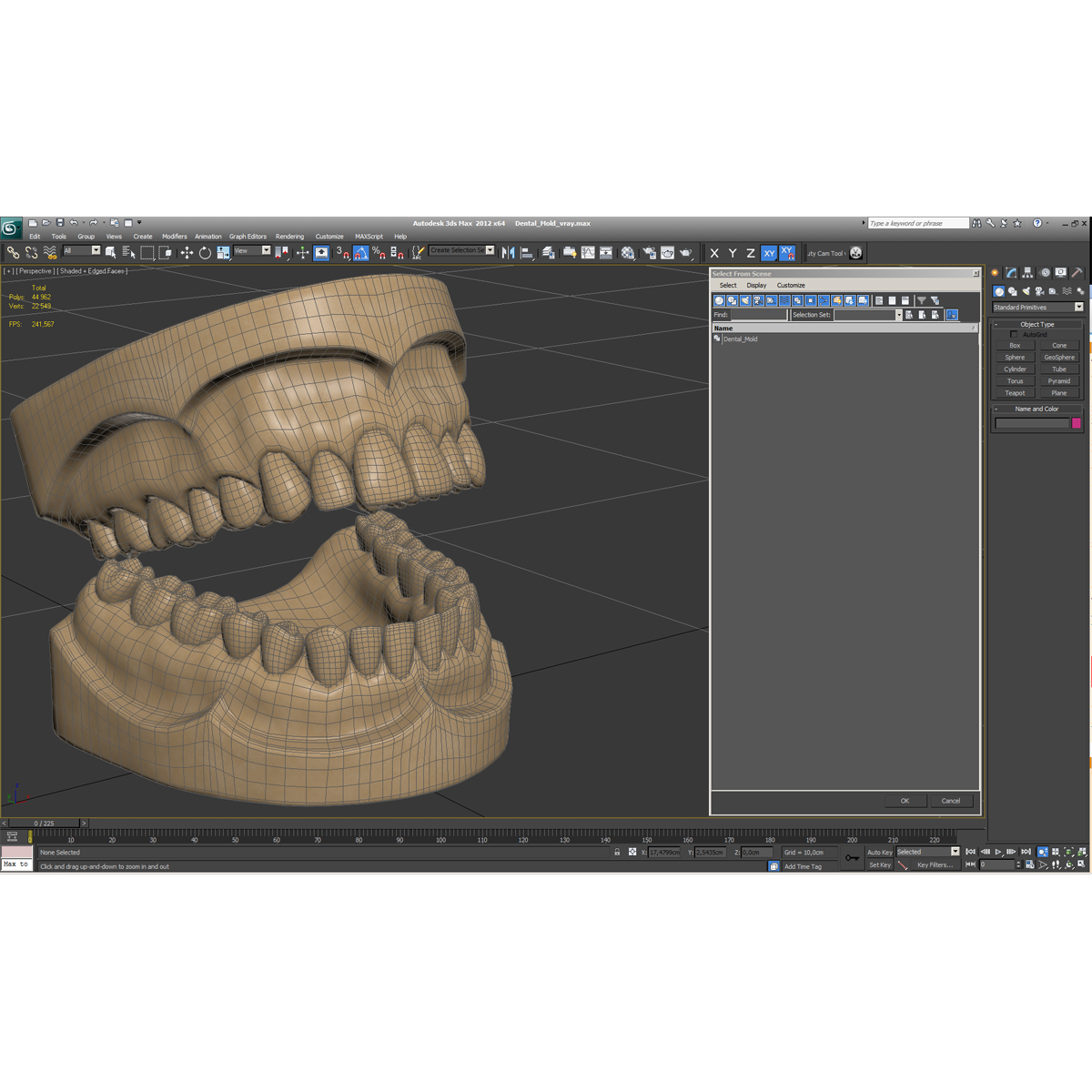 3D Dental Mold