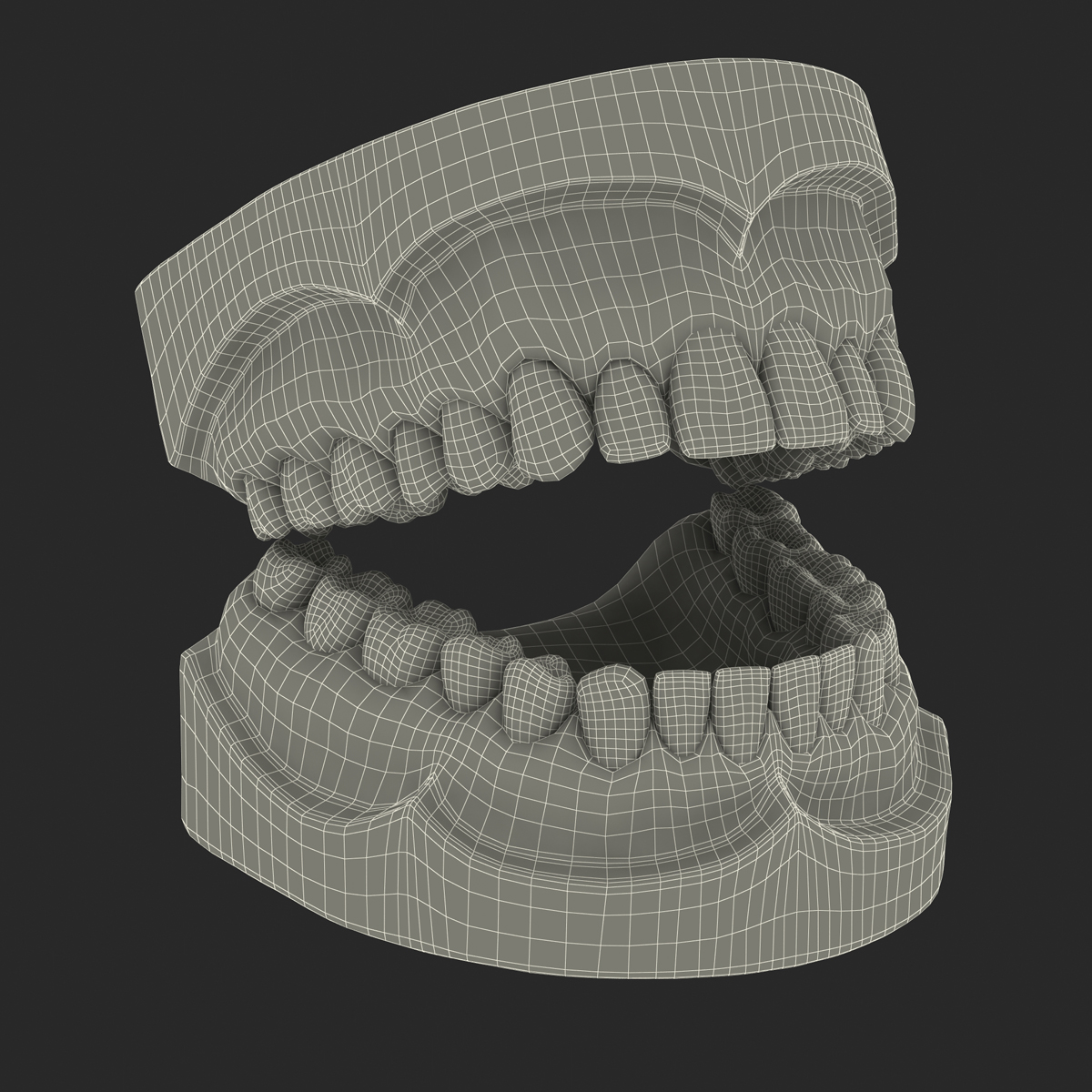 3D Dental Mold