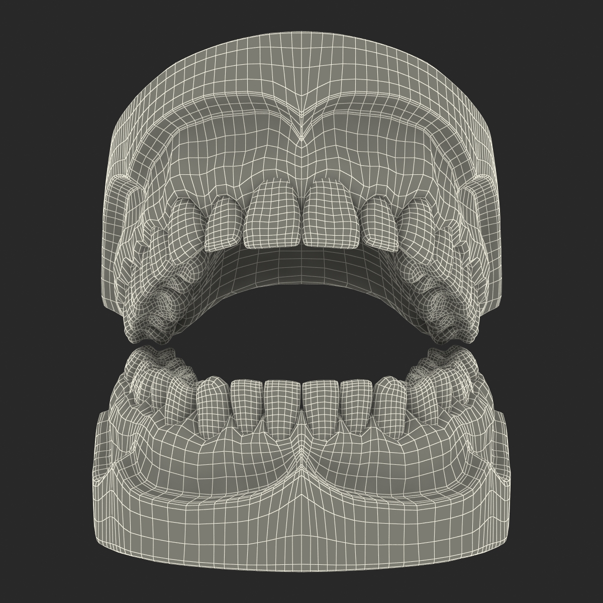 3D Dental Mold