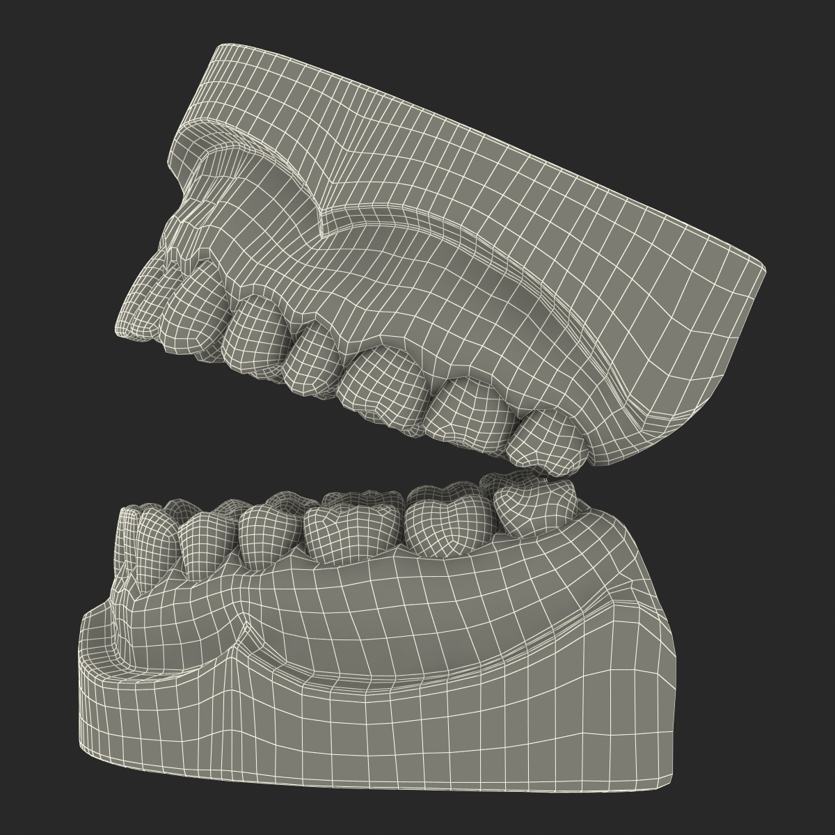 3D Dental Mold