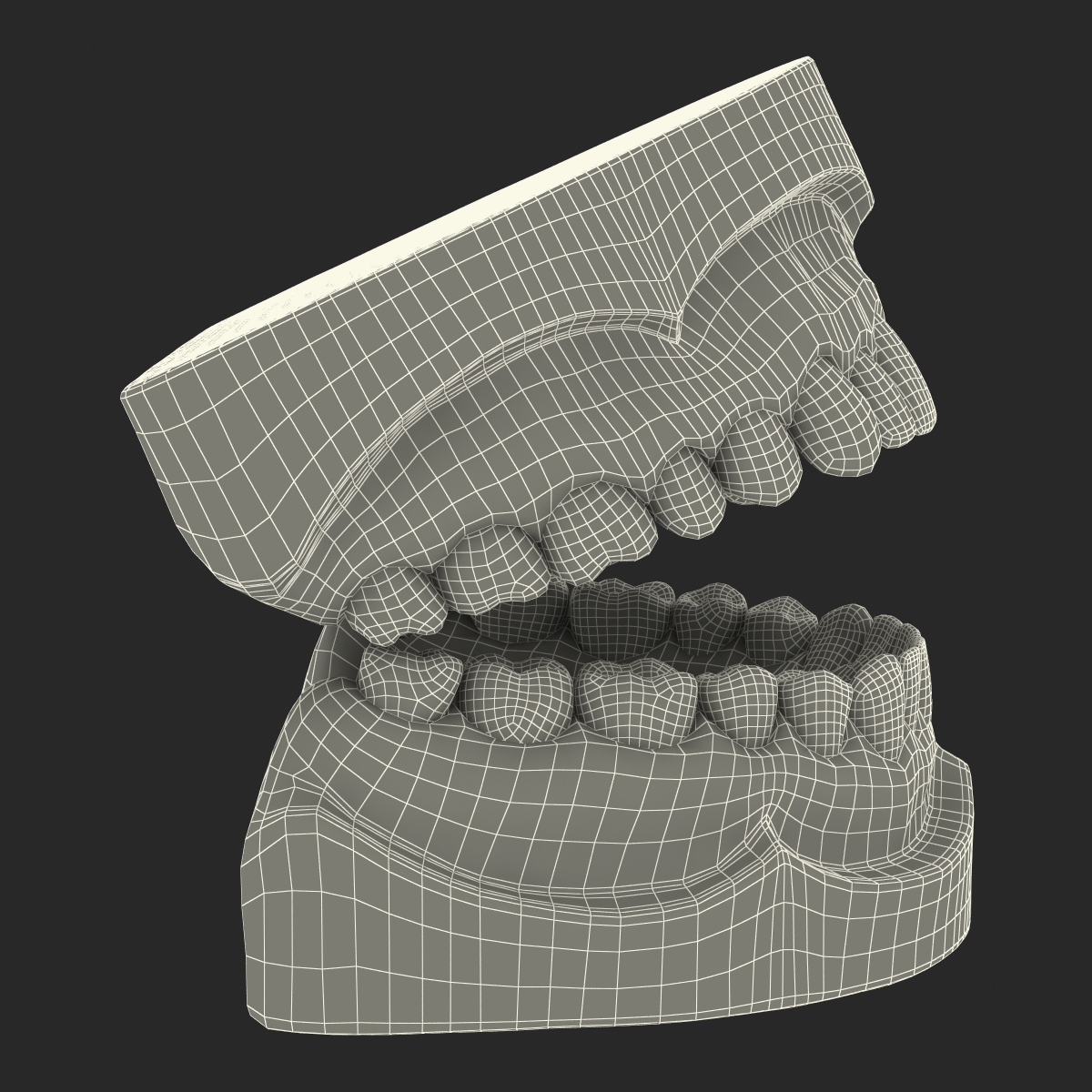 3D Dental Mold