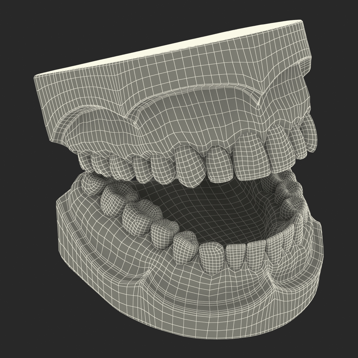 3D Dental Mold