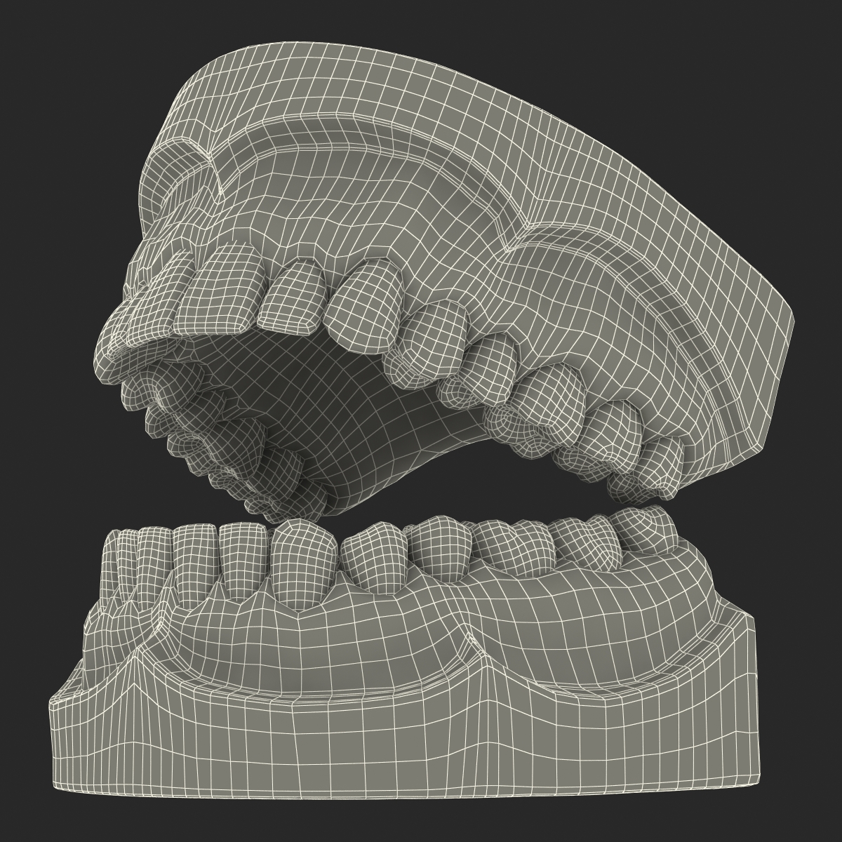 3D Dental Mold