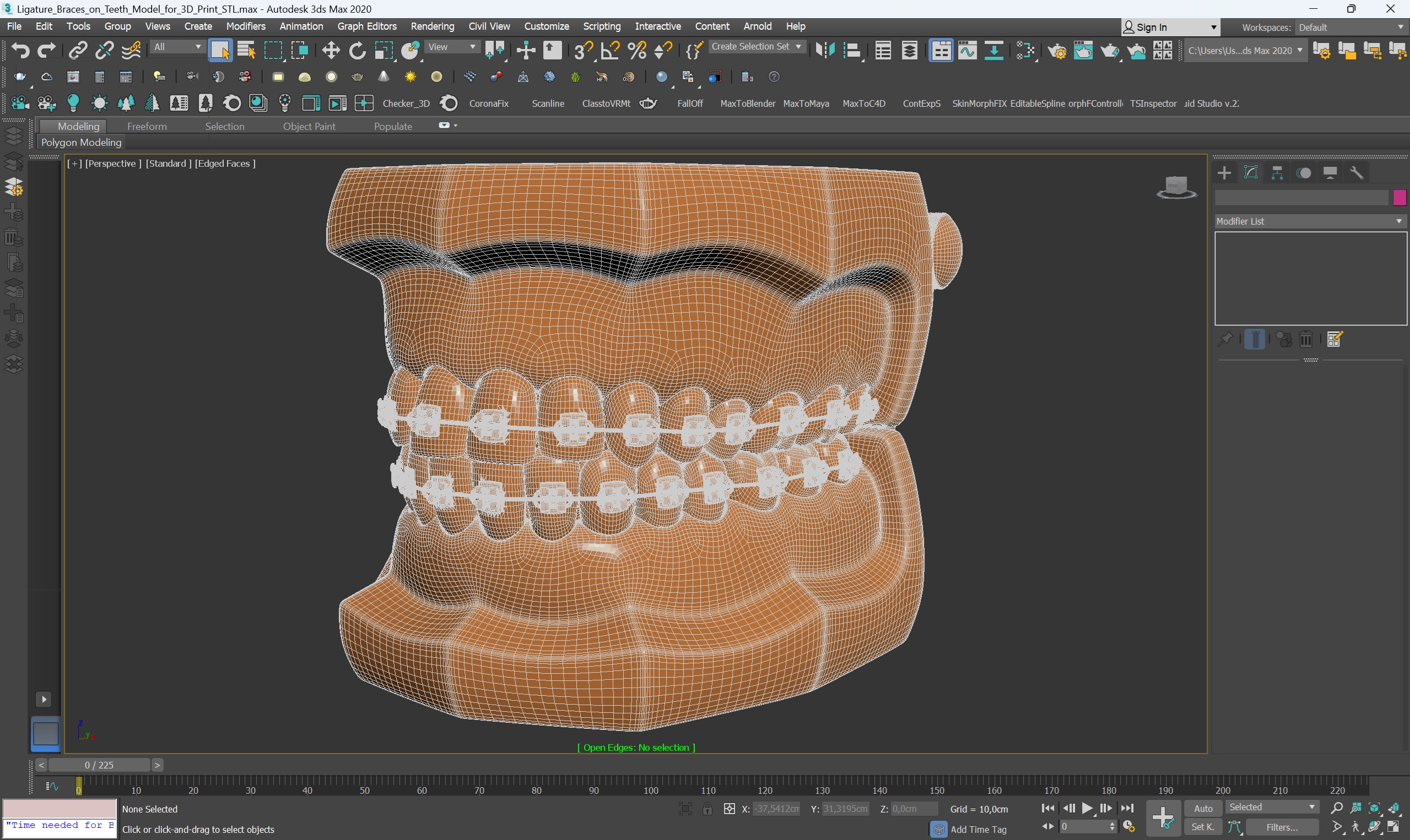 3D Ligature Braces on Teeth Model for 3D Print model