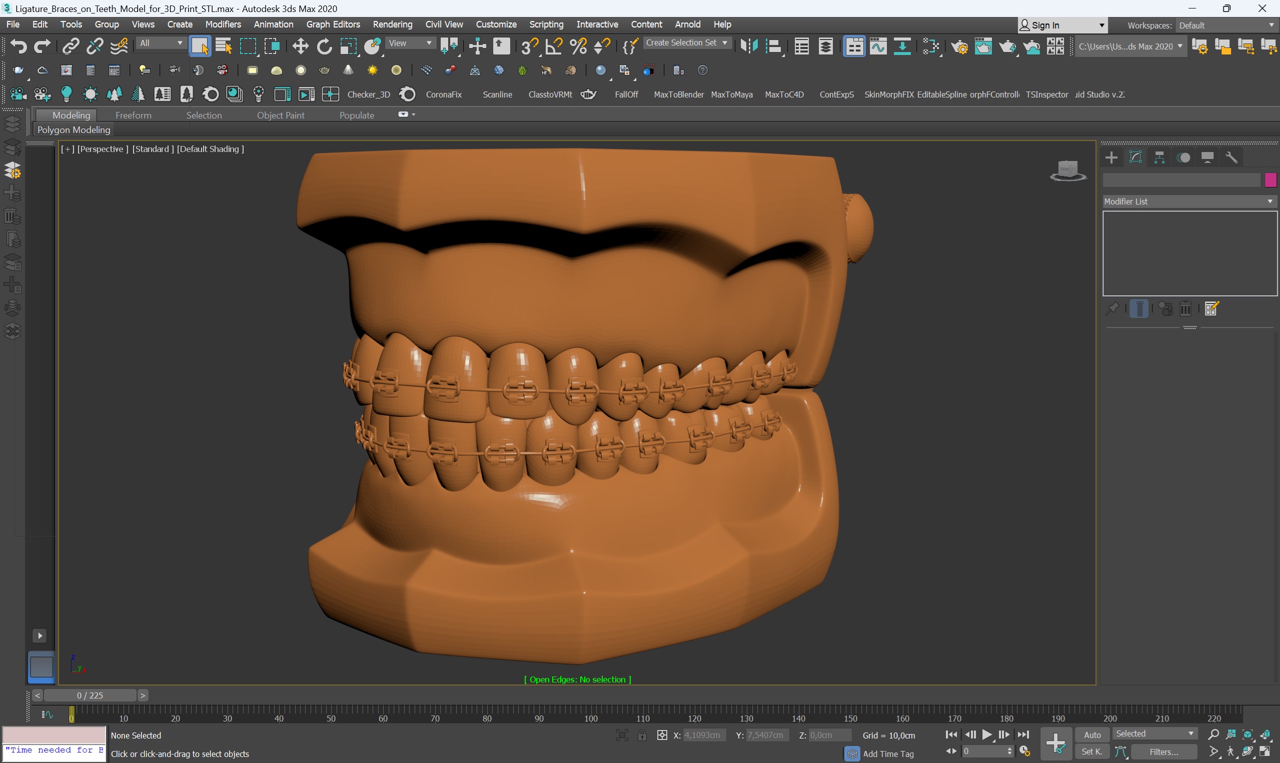 3D Ligature Braces on Teeth Model for 3D Print model