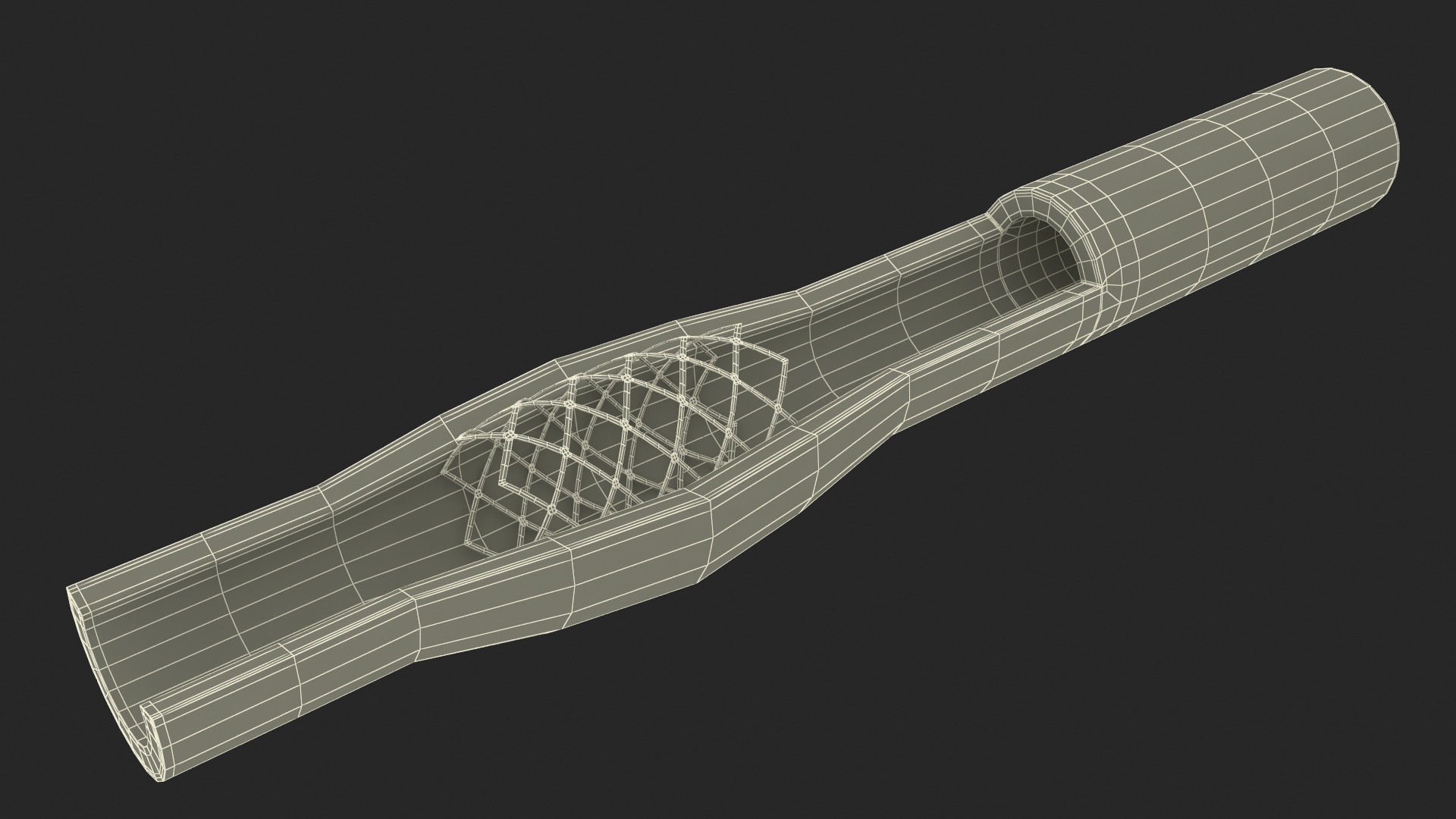 3D Plastic Models of Stents with Artery