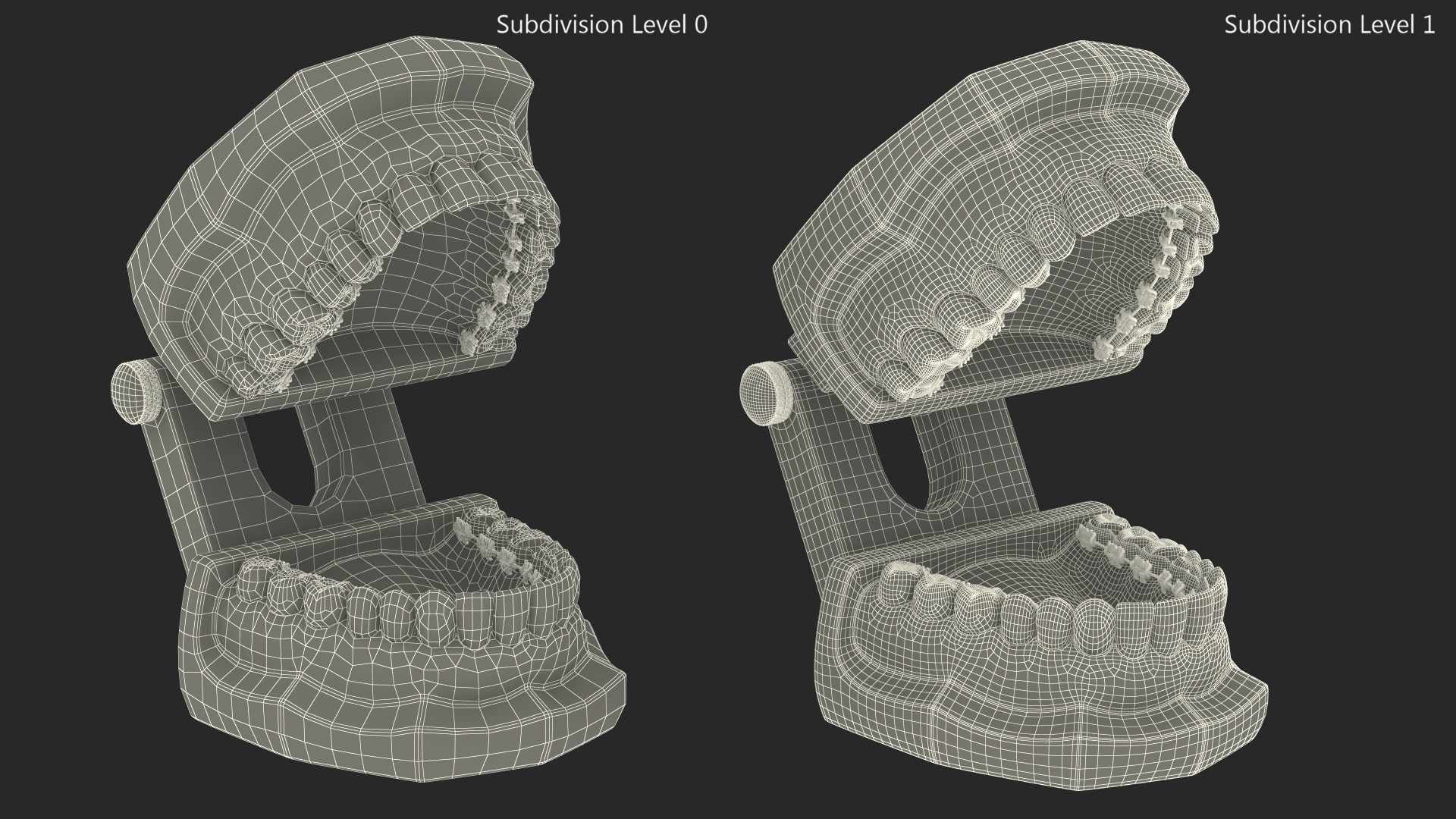 3D Lingual Braces on Typodont Teeth Model model