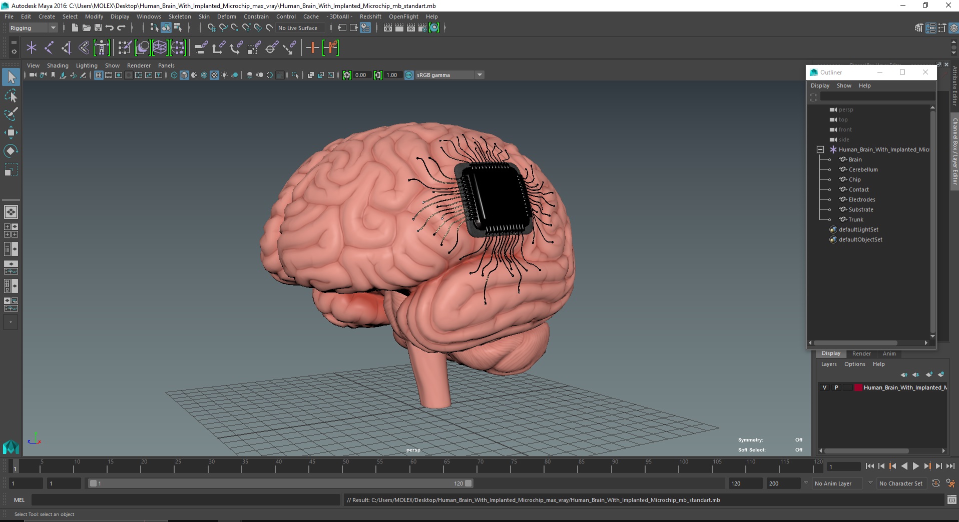 3D Human Brain With Implanted Microchip