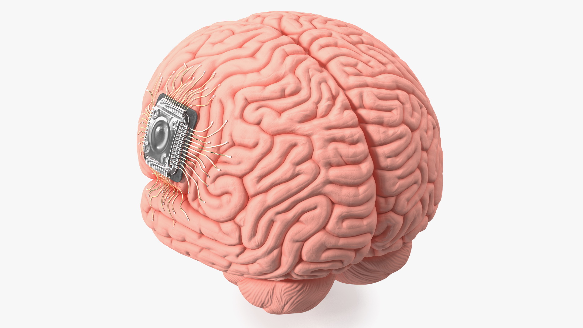 3D Human Brain With Implanted Microchip