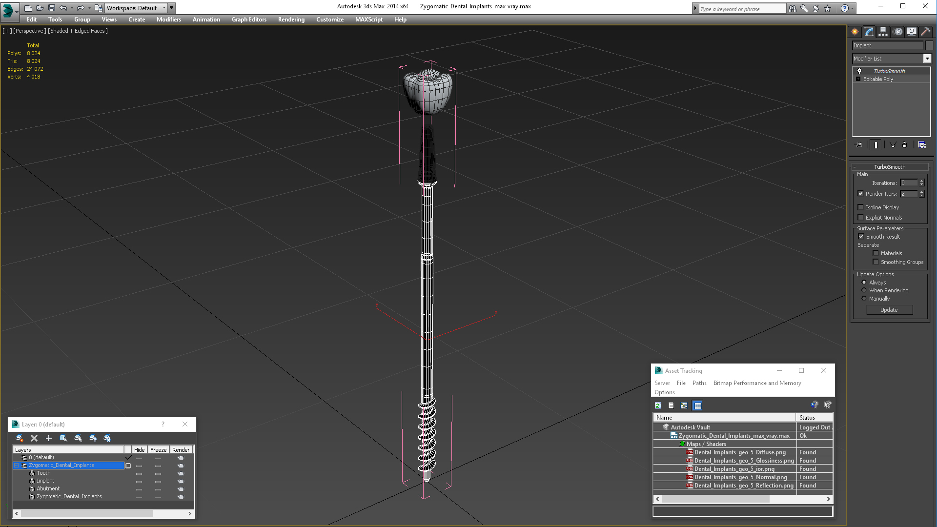 3D model Zygomatic Dental Implants