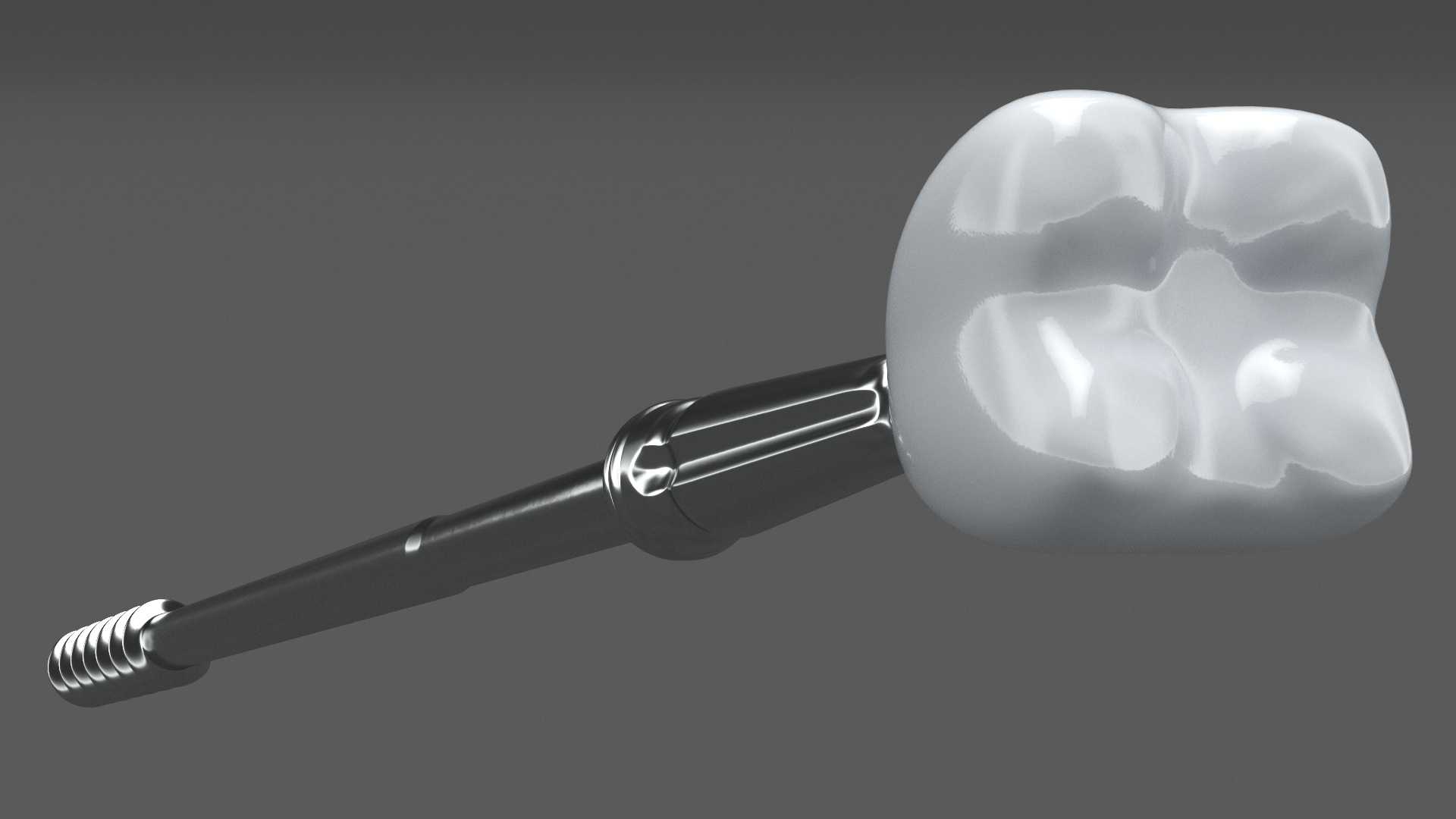 3D model Zygomatic Dental Implants