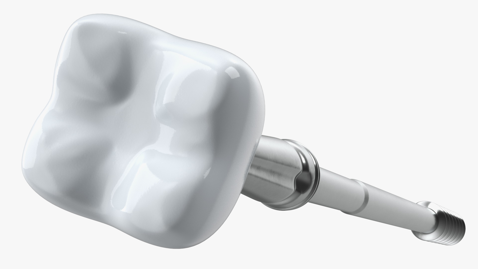 3D model Zygomatic Dental Implants