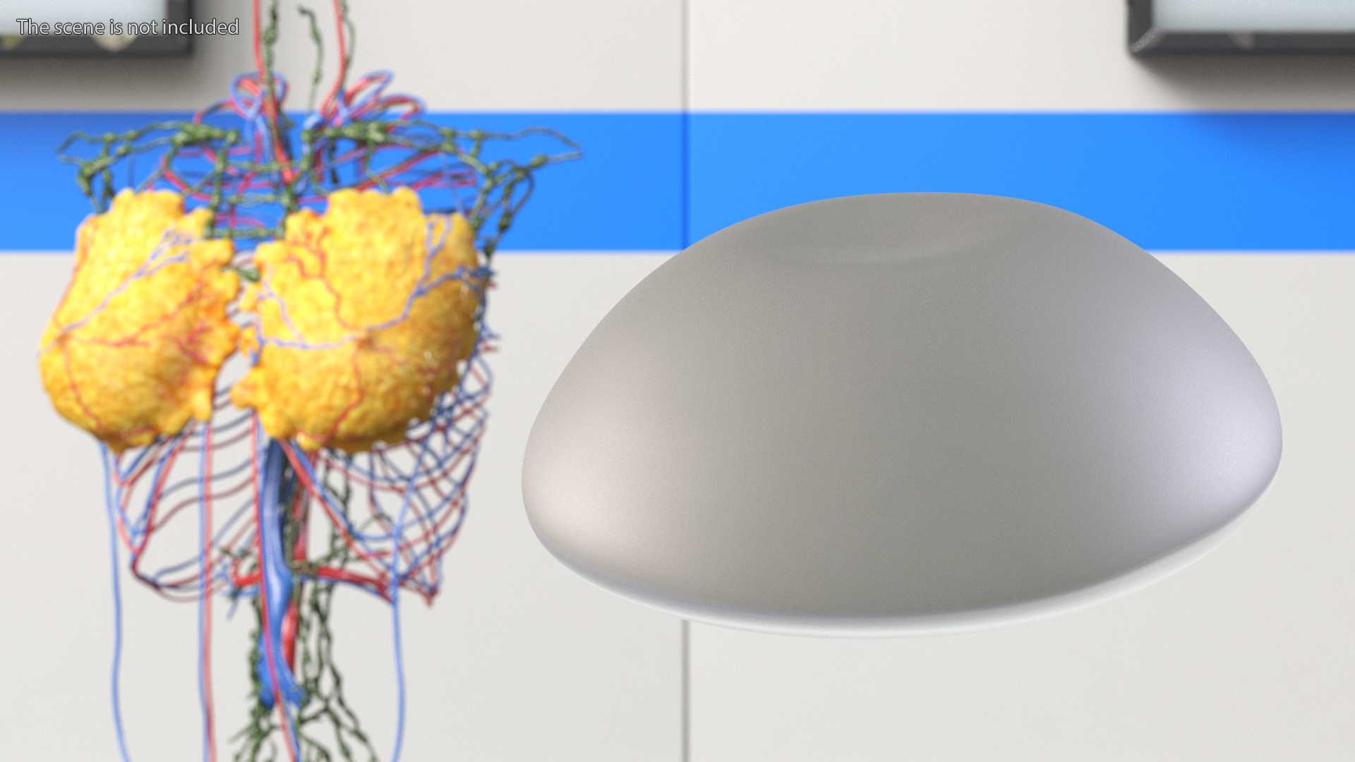 3D Textured Full Breast Implant model