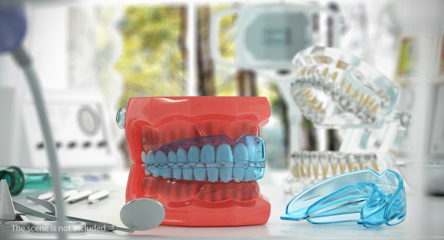 3D Orthodontic Braces Retainers model