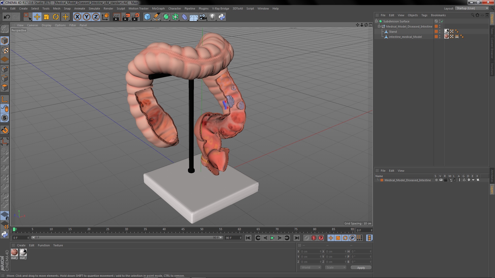 Medical Model Diseased Intestine 3D