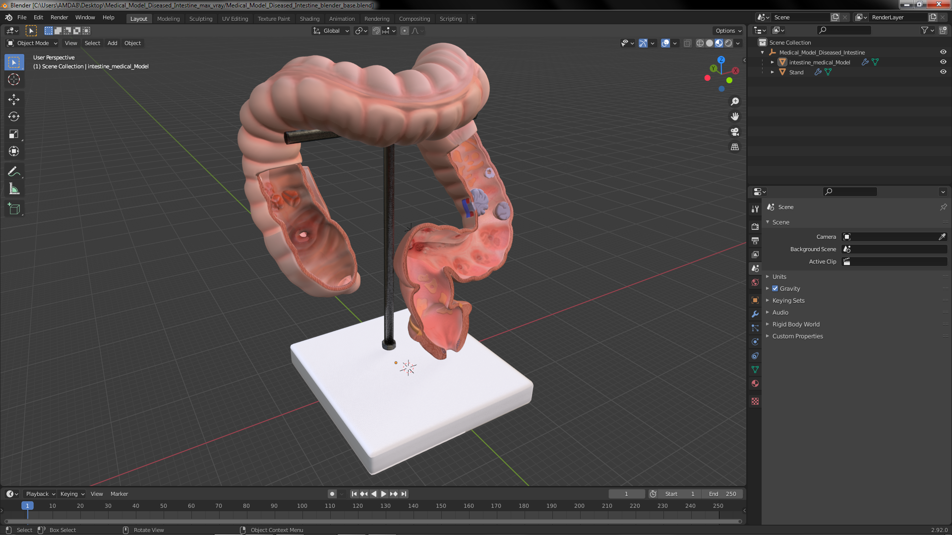 Medical Model Diseased Intestine 3D