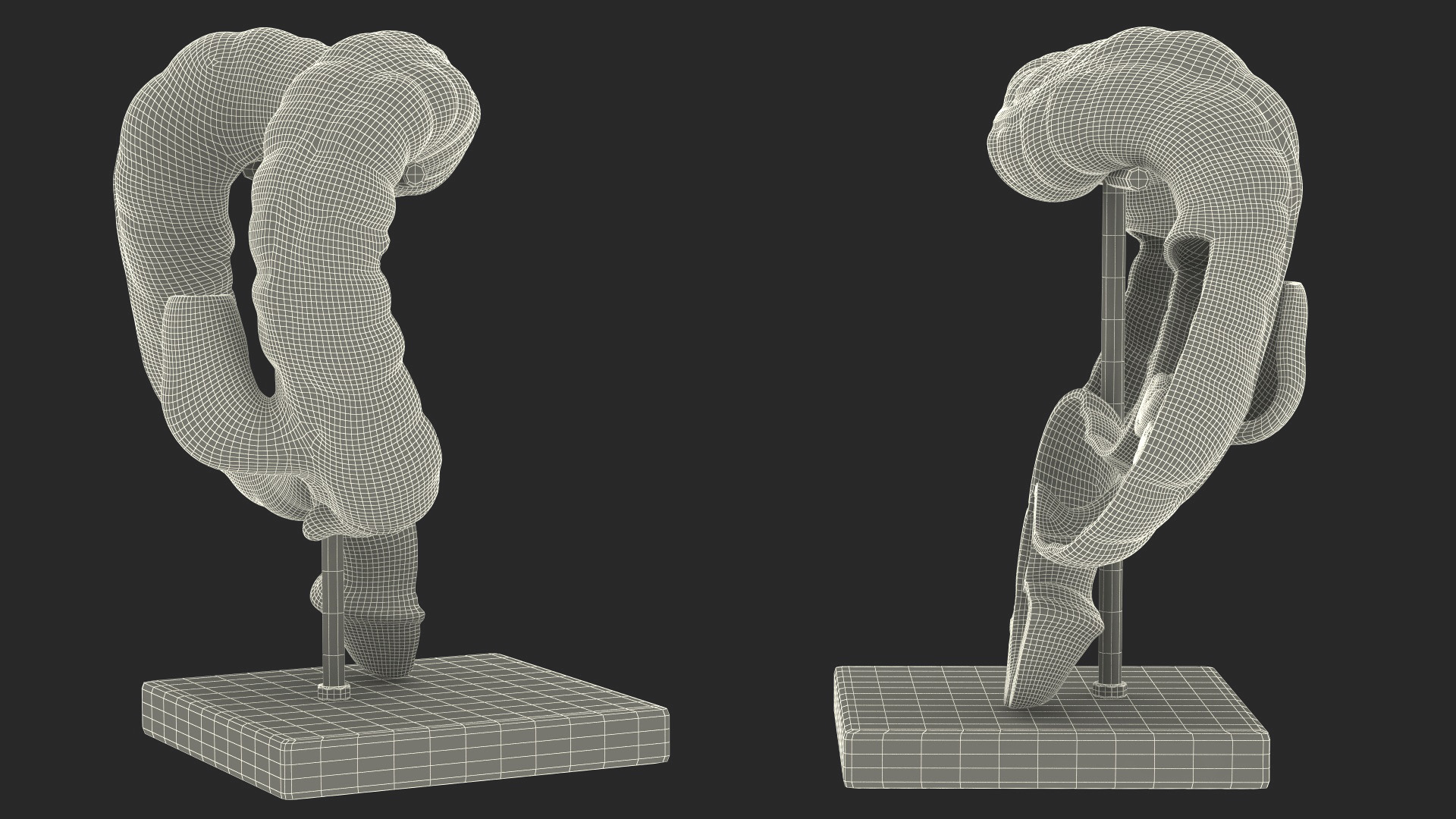 Medical Model Diseased Intestine 3D