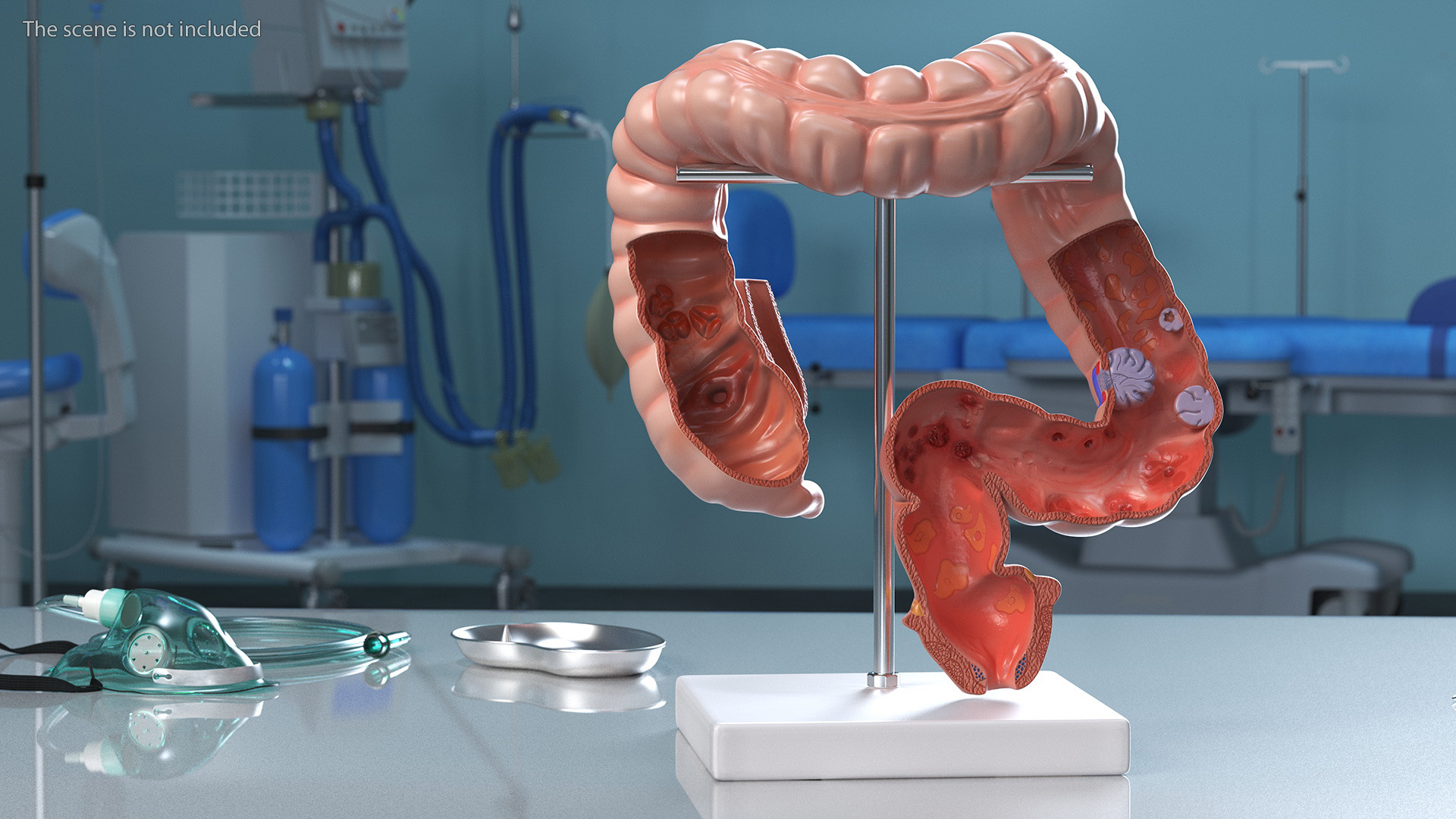 Medical Model Diseased Intestine 3D