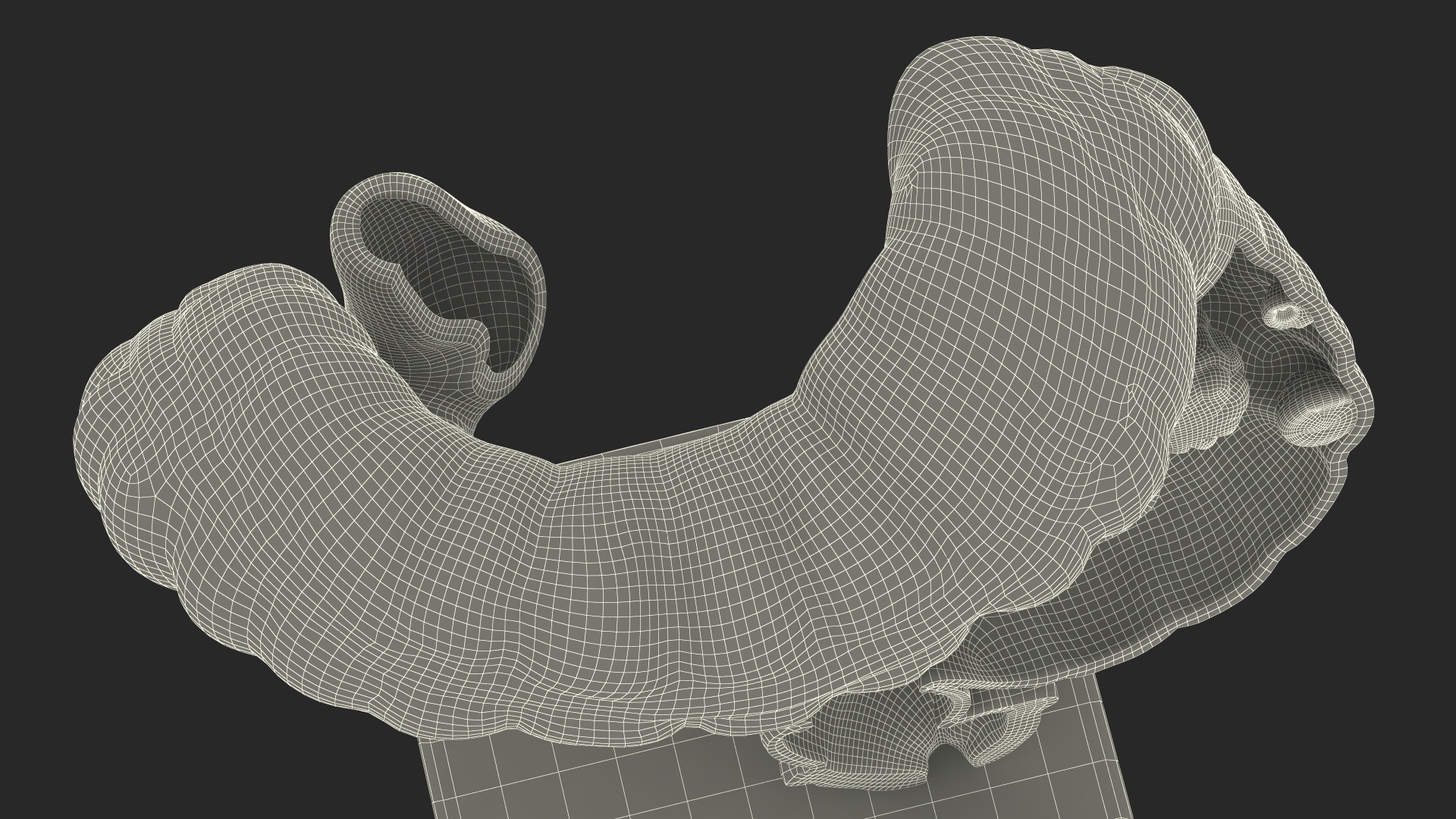 Medical Model Diseased Intestine 3D