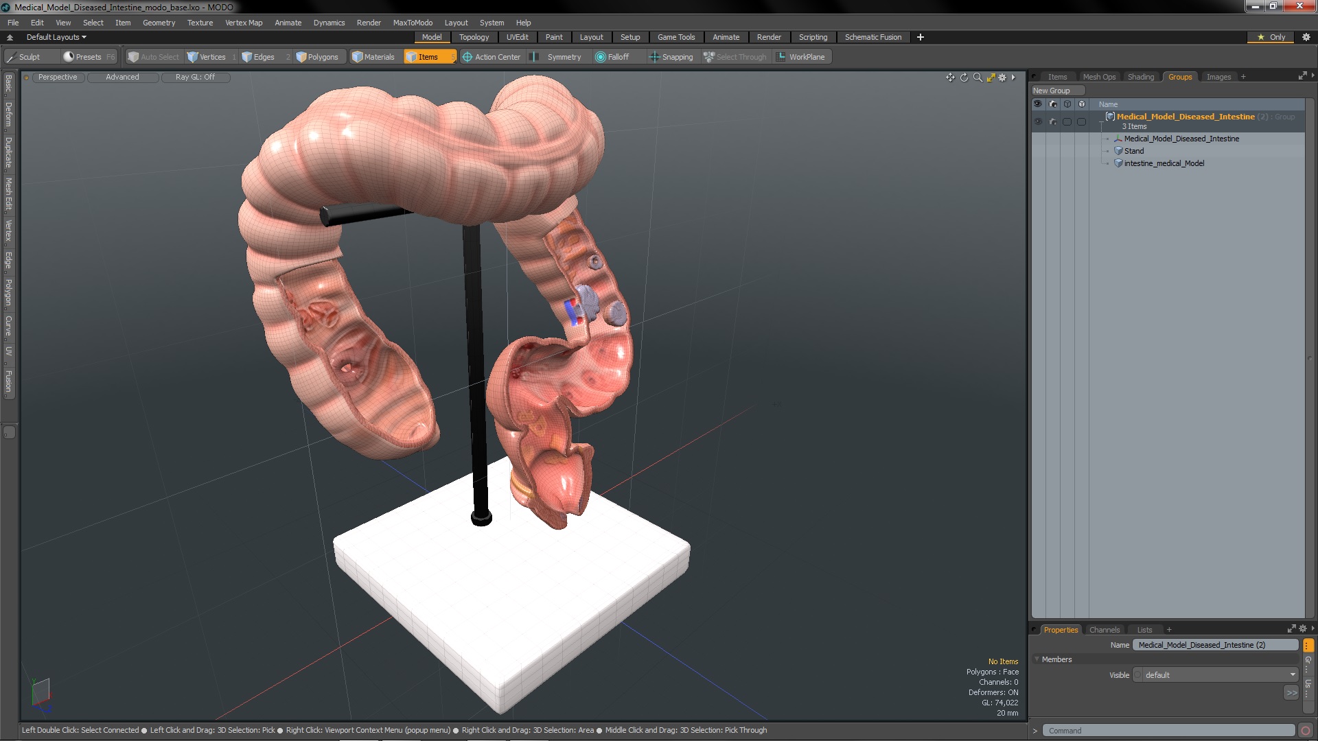 Medical Model Diseased Intestine 3D