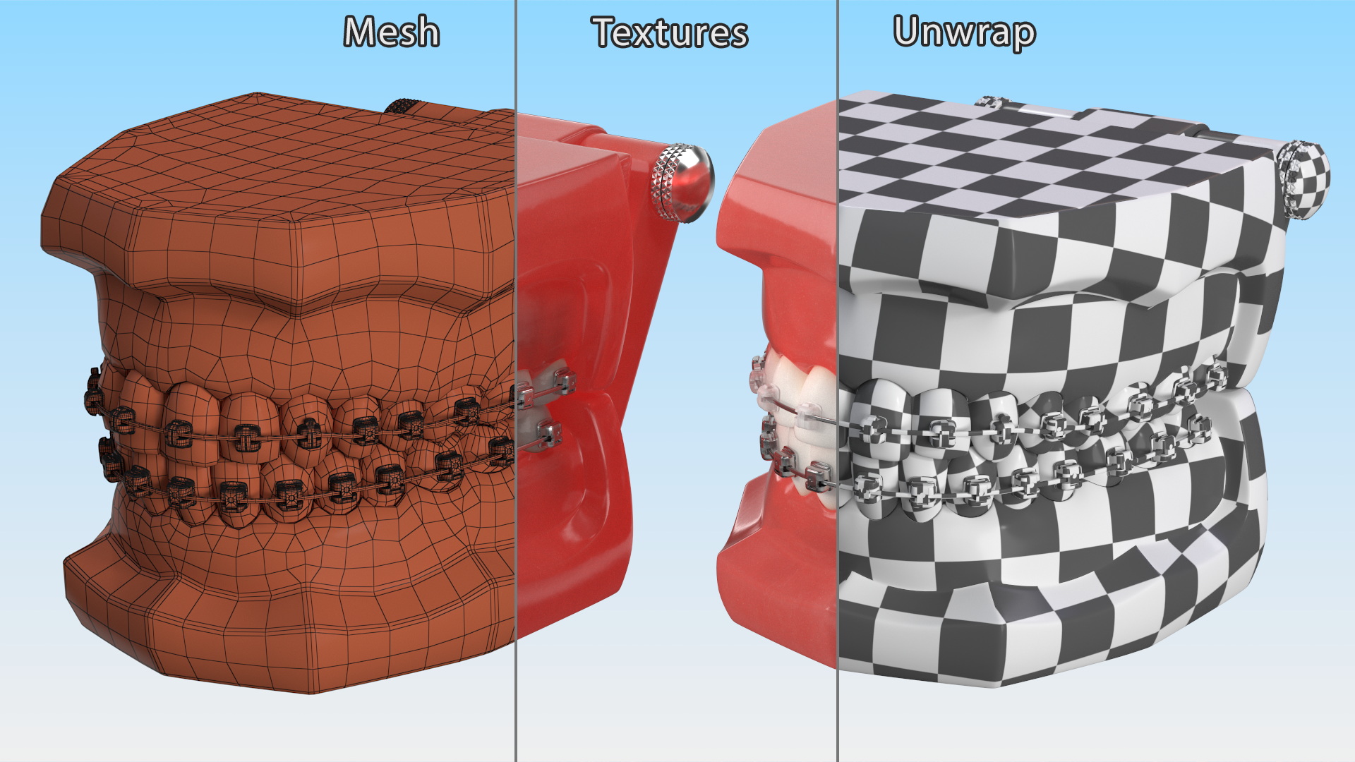 3D Ligature-Free Braces on Artificial Jaw model