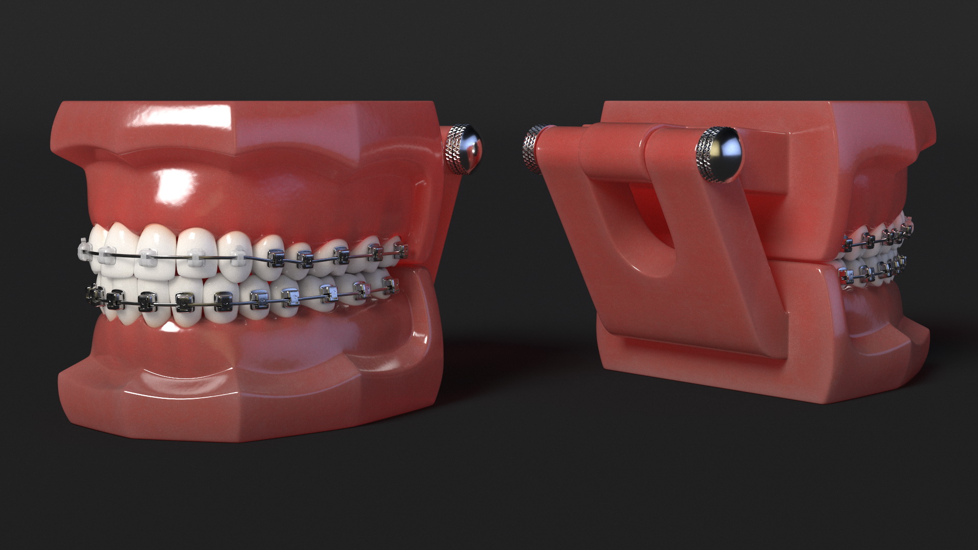 3D Ligature-Free Braces on Artificial Jaw model