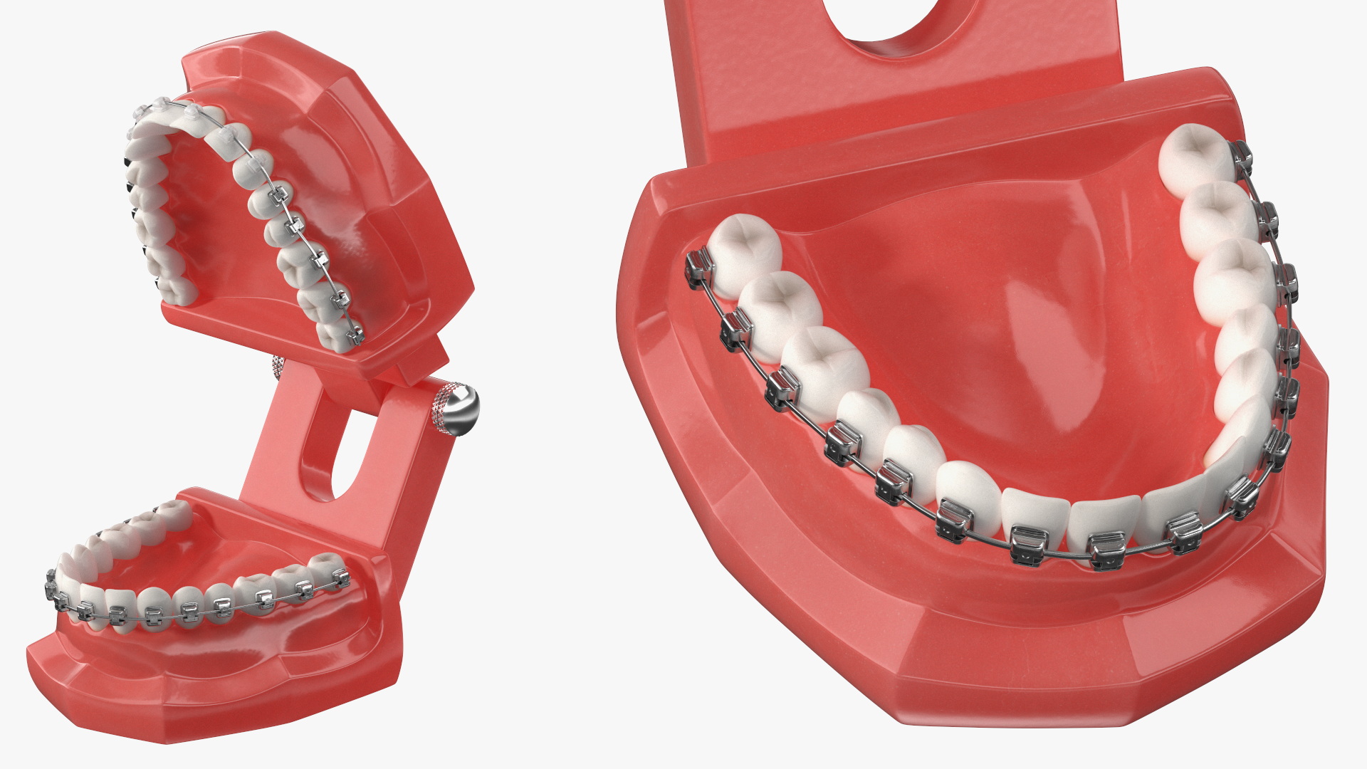 3D Ligature-Free Braces on Artificial Jaw model