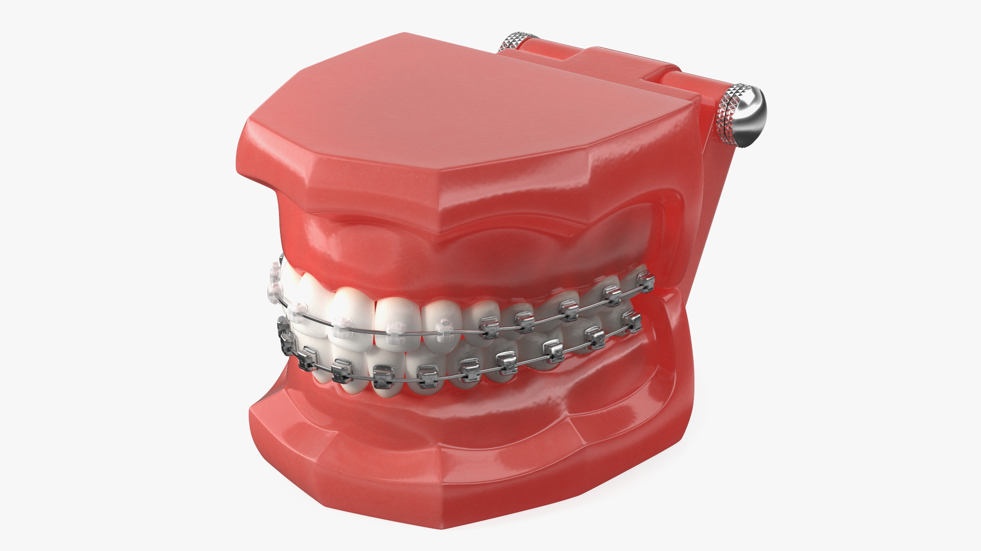 3D Ligature-Free Braces on Artificial Jaw model