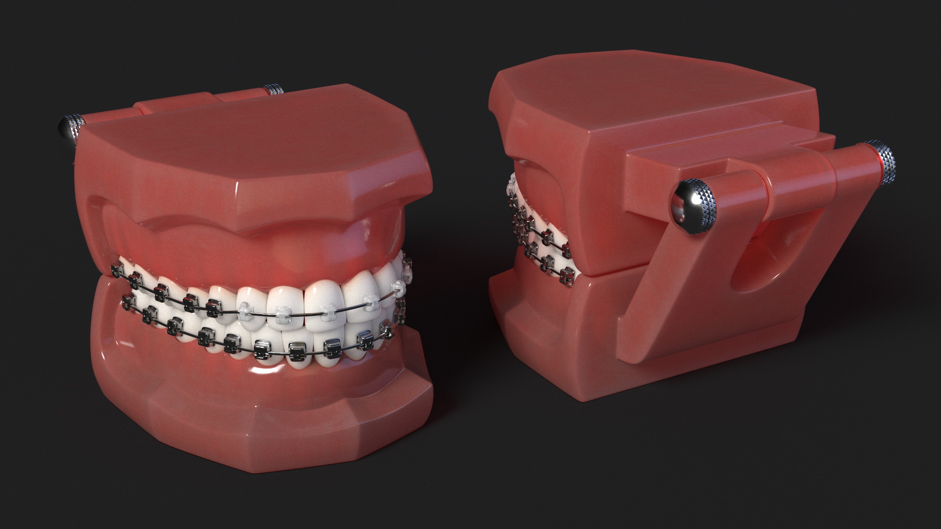 3D Ligature-Free Braces on Artificial Jaw model