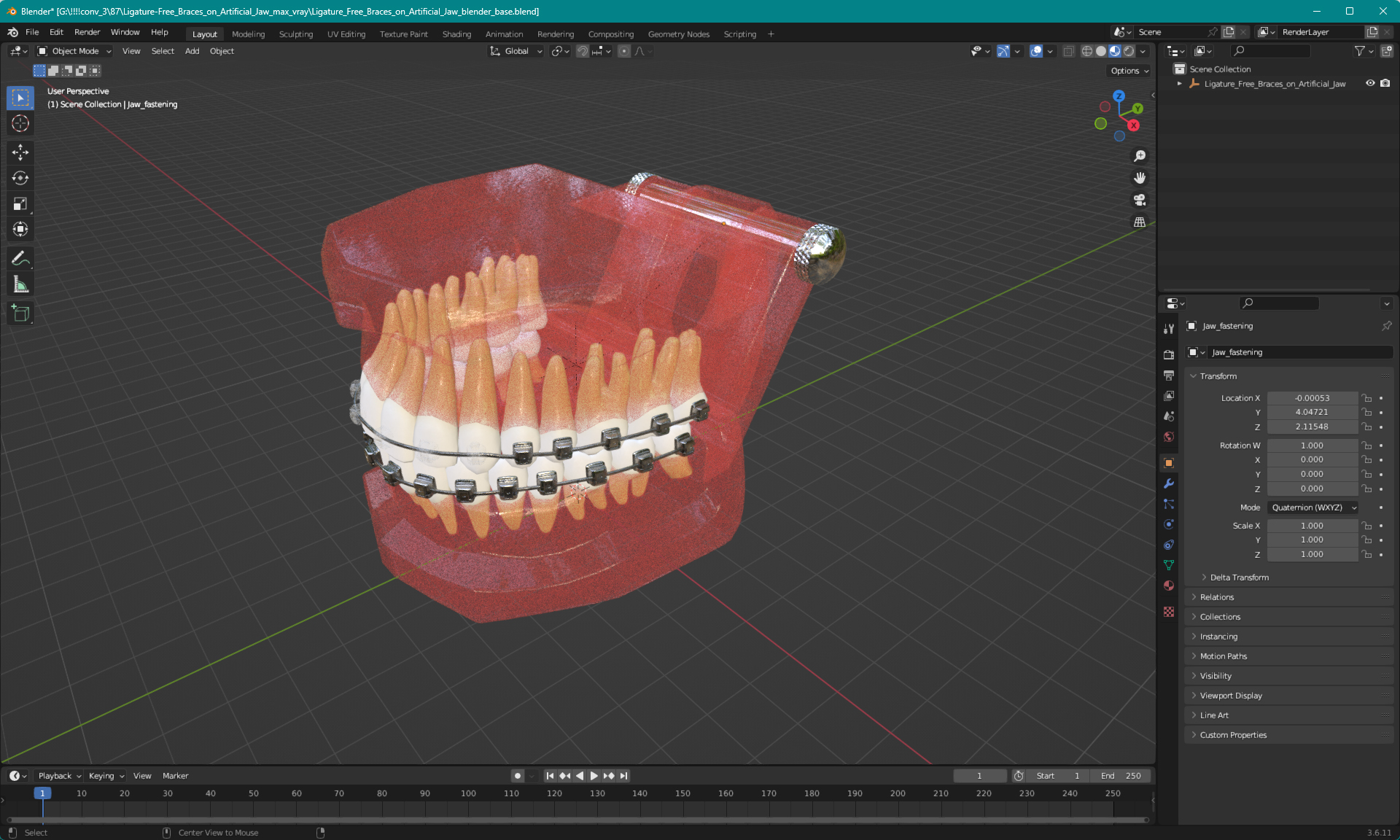 3D Ligature-Free Braces on Artificial Jaw model