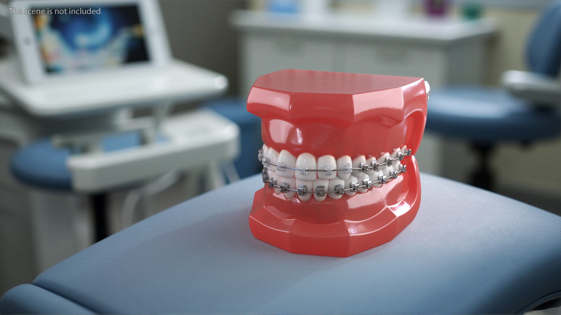 3D Ligature-Free Braces on Artificial Jaw model