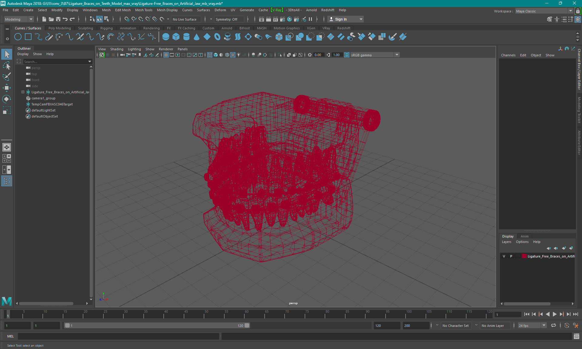 3D Ligature-Free Braces on Artificial Jaw model