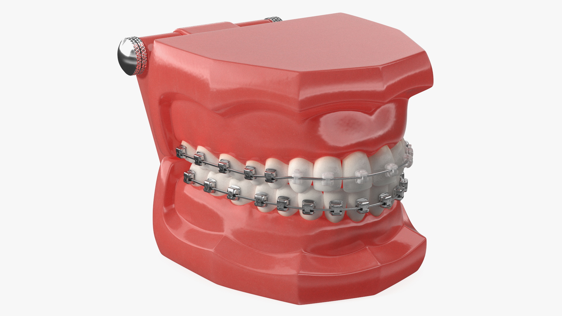 3D Ligature-Free Braces on Artificial Jaw model