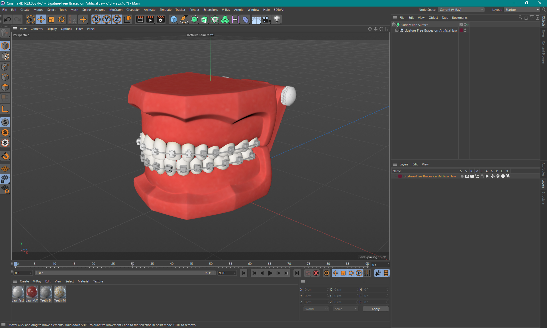 3D Ligature-Free Braces on Artificial Jaw model