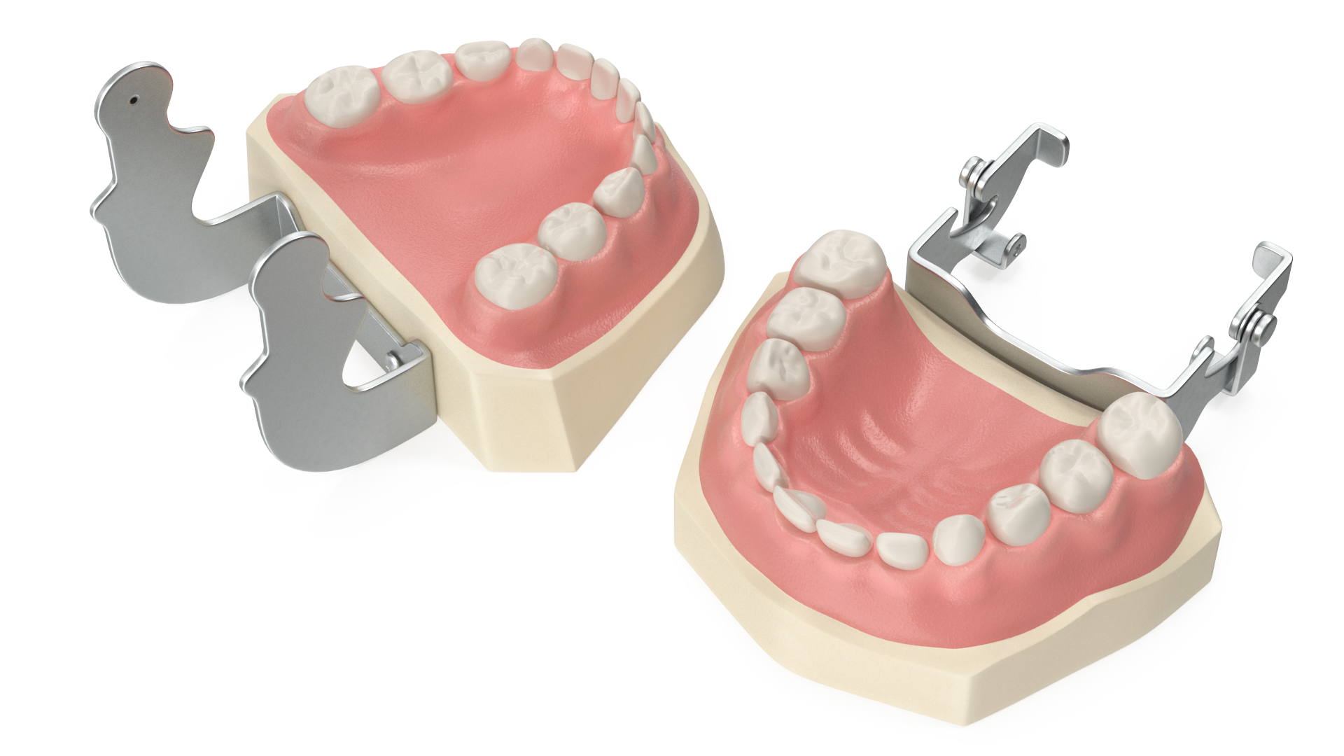 3D Dental Anatomy Educational Pediatric Kit with Removable Open Bite Teeth