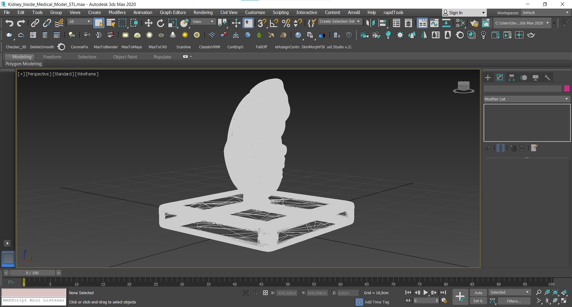 3D model Kidney Inside Medical Model for 3D Print