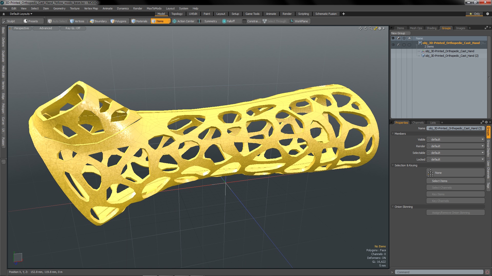 3D 3D-Printed Orthopedic Cast Hand Yellow model