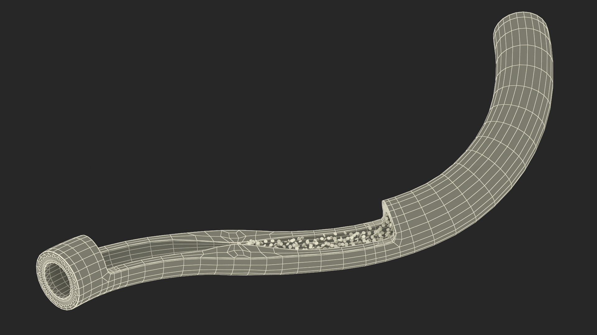 3D Cholesterol Blocked Artery in Cross Section model