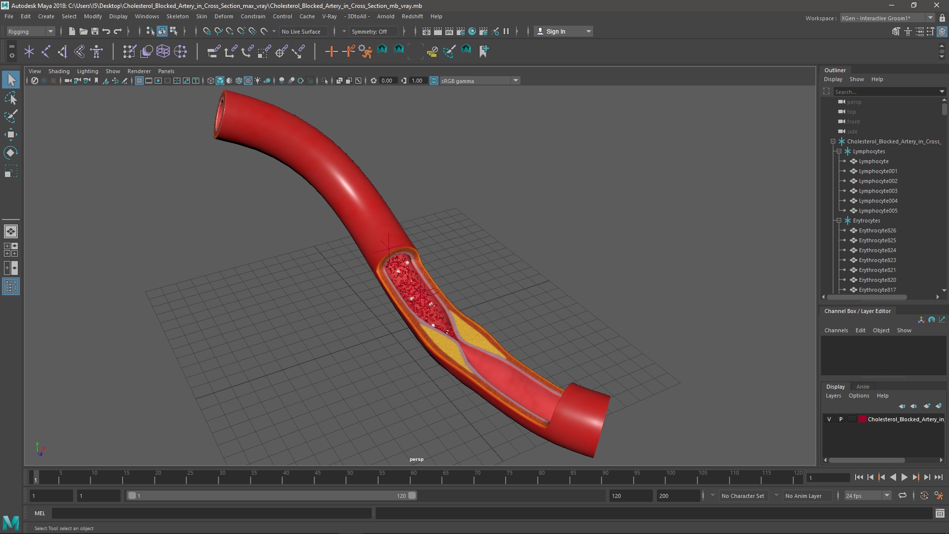 3D Cholesterol Blocked Artery in Cross Section model