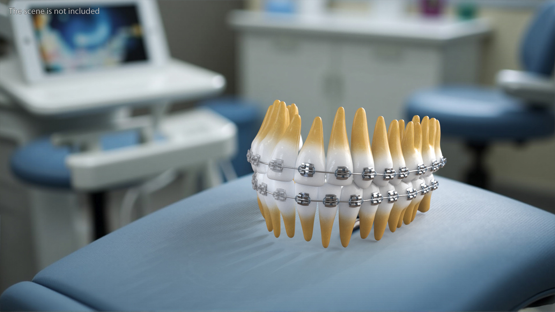 3D model Ligature Braces on Artificial Teeth