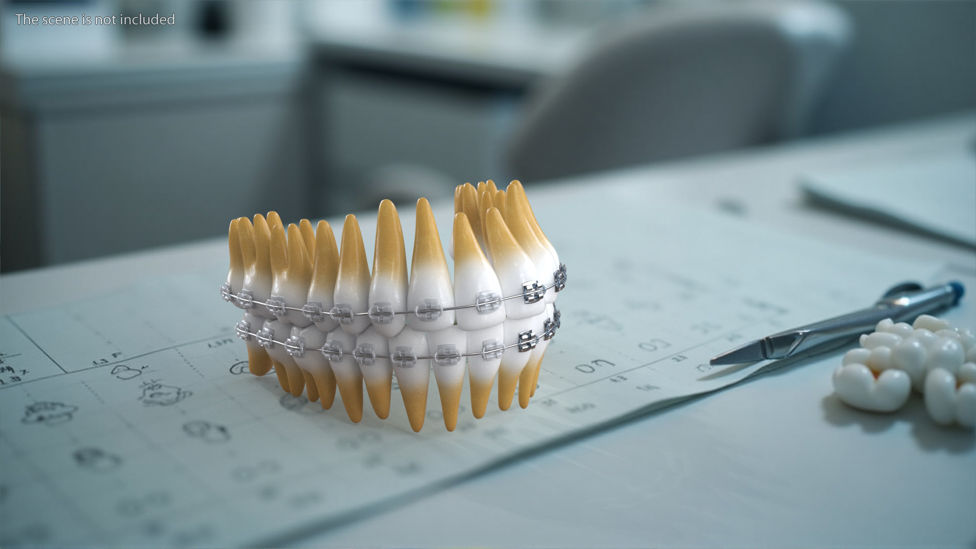 3D model Ligature Braces on Artificial Teeth