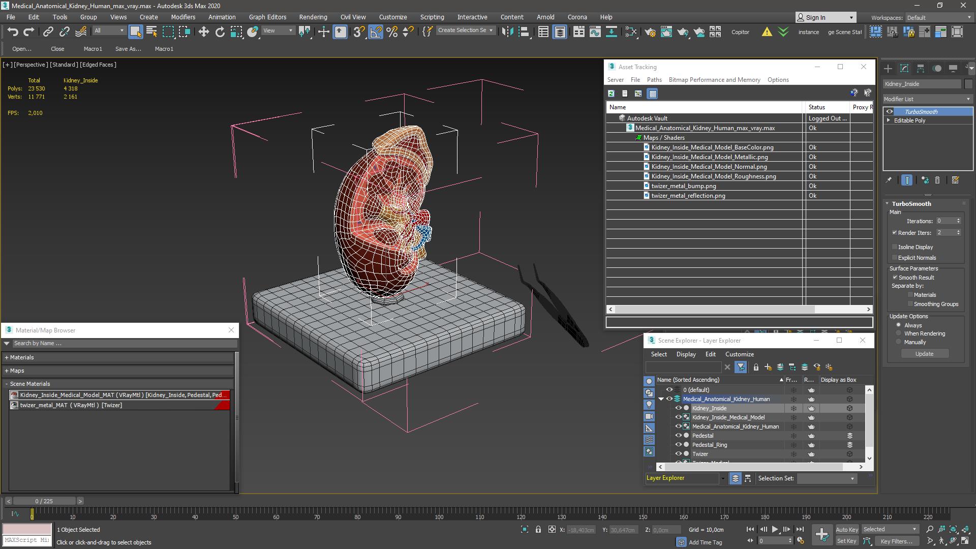 3D Medical Anatomical Kidney Human