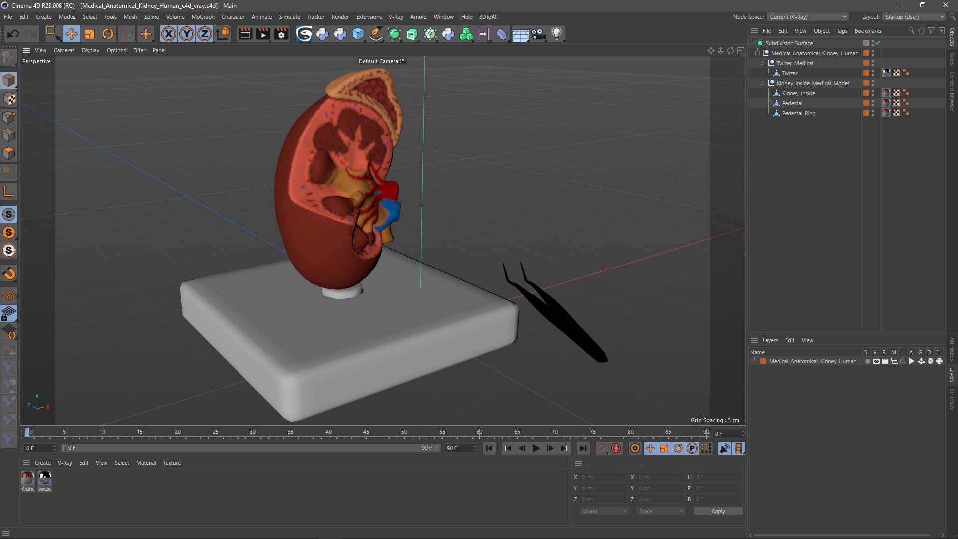 3D Medical Anatomical Kidney Human