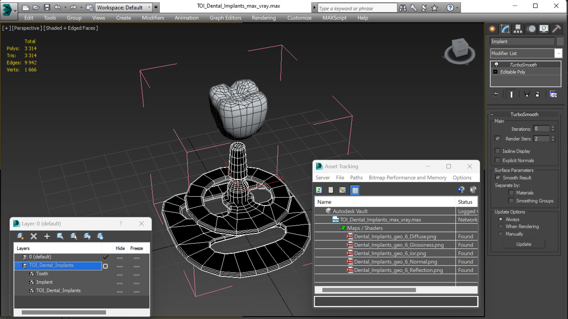 TOI Dental Implants 3D model