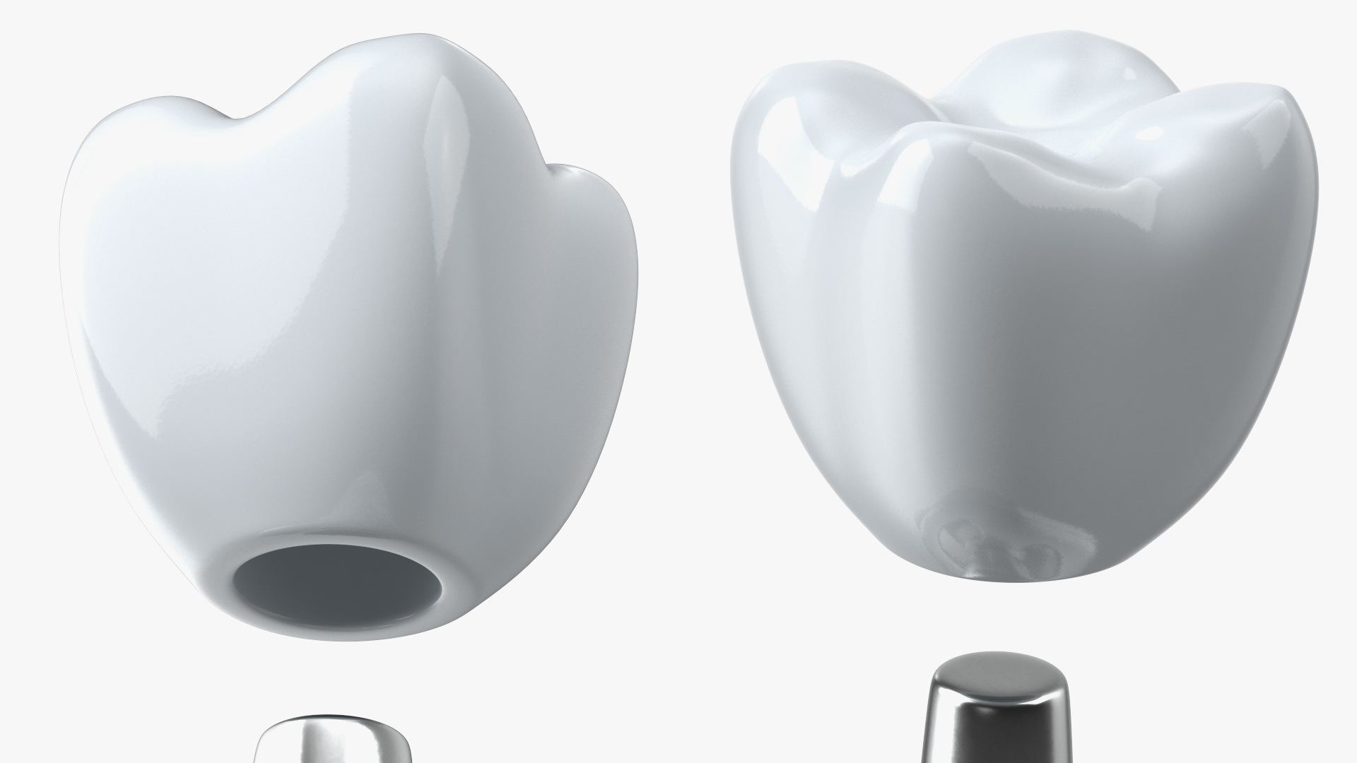 TOI Dental Implants 3D model